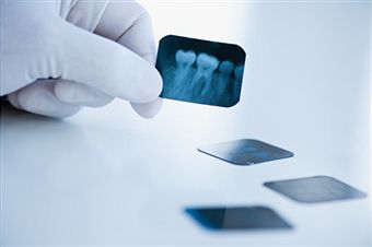 Dental x-rays