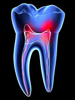 Tooth Sensitivity: New Findings